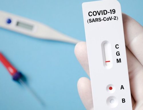 Sars-CoV-2 Antikörper Test
